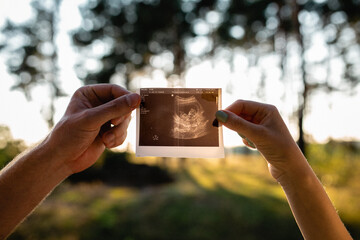 a couple in love looking at the ultrasound of an unborn child, a pregnant woman and her husband...