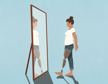Woman with prosthetic leg looking in mirror
