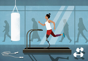 Amputee with prosthetic leg jogging on treadmill at gym
