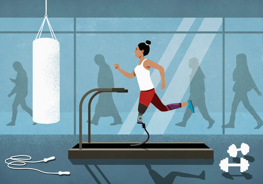 Amputee with prosthetic leg jogging on treadmill at gym
