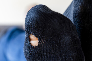 Close-up of a sock with a hole in it
