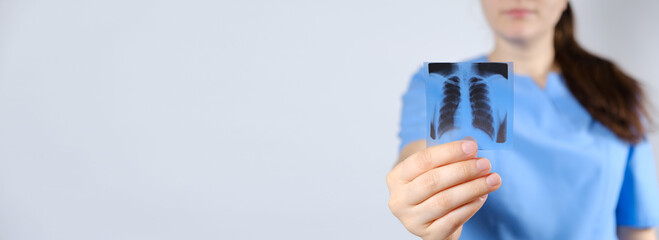A doctor in a blue uniform shows a picture of a fluorogram of fluorography, an X-ray of the lungs.