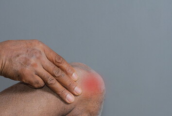 Fototapeta premium knee pain problem after doing sport activities stock photo