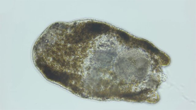 Worm Turbellaria, order Acoela under a microscope. In symbiosis with Zooxanthellae algae, which give him energy. Indian Ocean