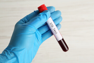 Scientist holding tube with blood sample and label STD Test on white background, closeup