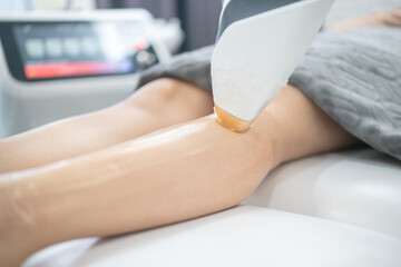 Epilation laser, hair removal or Epilation hair on woman leg. Health and beauty.
