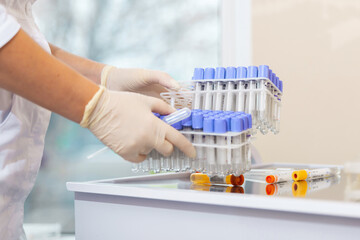 Test tube in scientist hand in laboratory. Doctor in uniform working with test tube for analysis in...