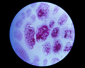 Gram staining, also known as Gram's method, is a method of differentiating bacterial species into...