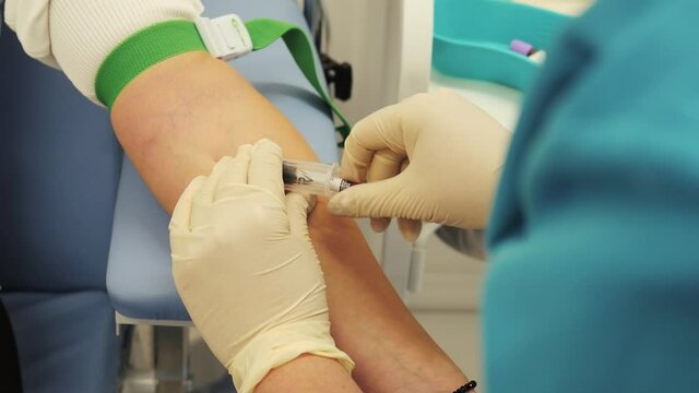 The nurse draws blood from a vein. The process of taking blood from a vein.