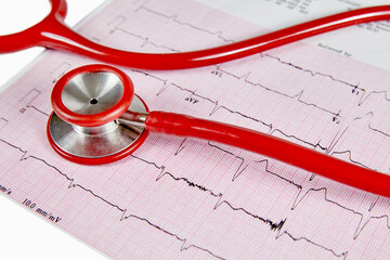 Abnormal Echocardiograph Report with a Red Stethoscope