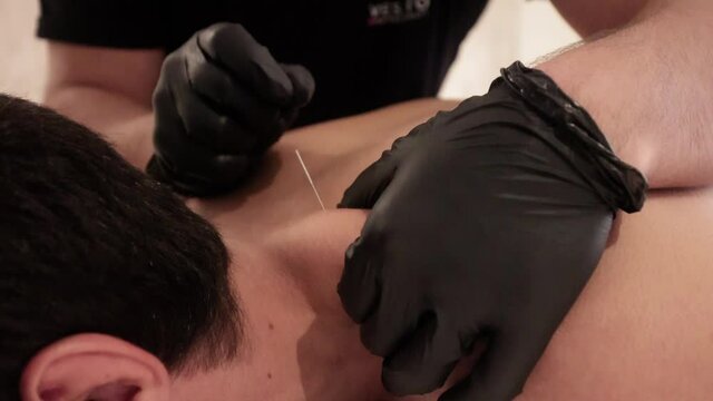 Acupuncturist inserting a needle in neck shoulder area of a lying male patient.