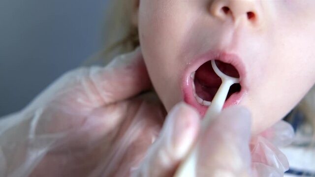 dentist, doctor examines oral cavity of small patient, uses mouth mirror, closeup baby teeth child, concept pediatric dentistry, dental treatment, correction of occlusion, oral care, caries prevention