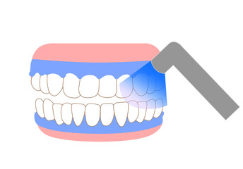 歯のホワイトニングのイラスト