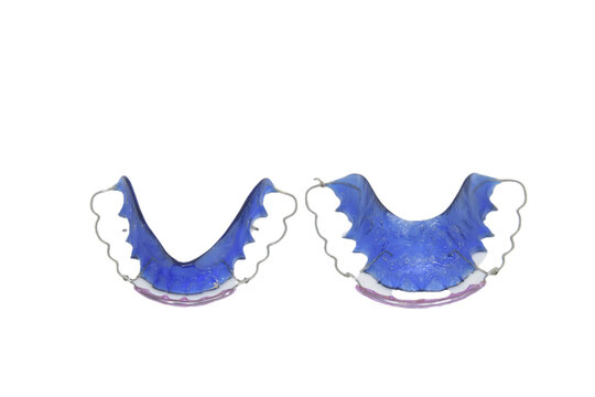 The retainer has stains and lacks good care. Retainer healthcare medical teeth mouth. Retainer blue on white isolated background. With clipping path.