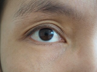 Obraz premium Young woman is squinting, strabismus concept. closeup photo, blurred.