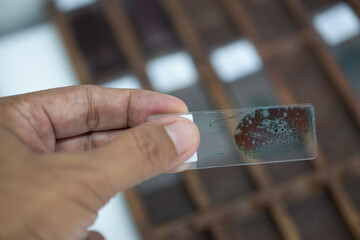 Medical scientists dye cytology slides in hospital labs.