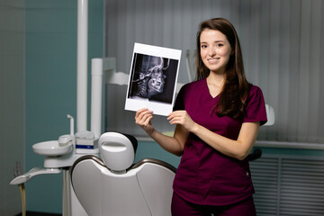 Beautiful woman doctor with dental scans in hands in a dental clinic