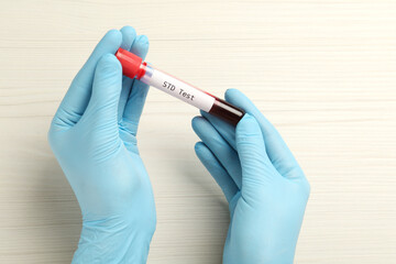 Scientist holding tube with blood sample and label STD Test at white table, top view