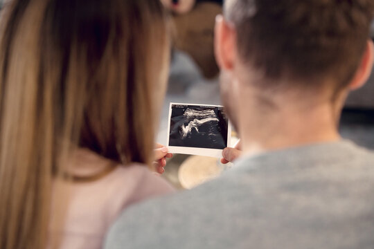 Young pregnant couple holding hands and looking ultrasonic picture