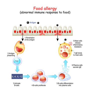 Food allergy. abnormal immune response to food.