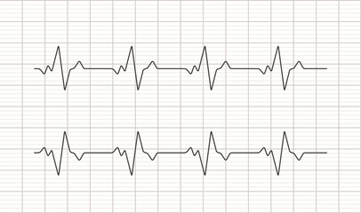Heartbeat ecg electrocardiogram vector graph wave line. Ekg cardio heart beat cardiology frequency monitor