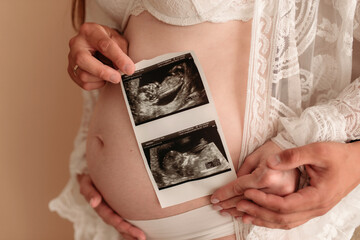 woman holding ultrasound scan