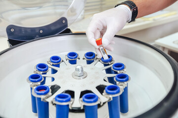 Technician loading a sample to centrifuge machine in the medical or scientific laboratory