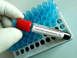 Researcher hold blood sample for New Variant of the Covid-19 Omicron B.1.1.529 test. A generic  of...