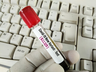 Researcher hold blood sample for New Variant of the Covid-19 Omicron B.1.1.529 test. A generic  of...
