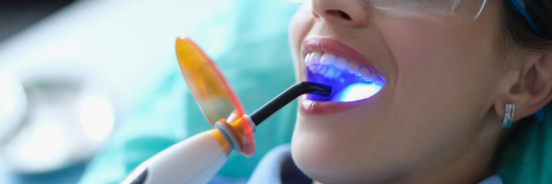 Dentist using dental ultraviolet curing light tool during procedure with patient in clinic