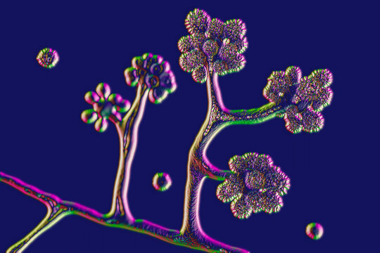 Microscopic Fungi Cunninghamella, Scientific 3D Illustration. Pathogenic Fungi From The Order Mucorales, Cause Sinopulmonary And Disseminated Infections