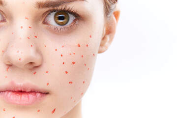 cheerful woman with bare shoulders dermatology pimples