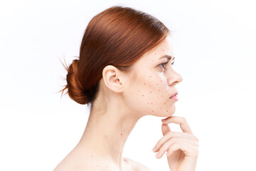 sad woman with bare shoulders red dots on her face