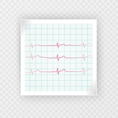 ECG tracing, heartbeat and heart rate line concept. Vector illustration