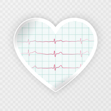 ECG tracing, heartbeat and heart rate line concept. Vector illustration