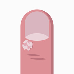 Wart on finger vector illustration isolated on white background.