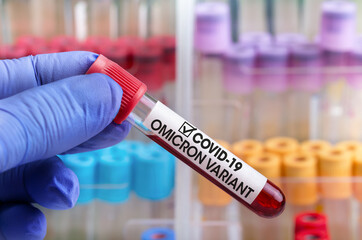 Doctor with blood sample of New Variant of Covid-19 Omicron B.1.1.529 and generic data of covid-19 Coronavirus Mutations. Researcher in analysis lab holding sample of new strain of covid Omicron - obrazy, fototapety, plakaty