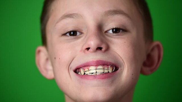 Smile baby, boy wears a plate for aligning teeth, dental care.