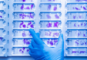 Hand in blue glove holding glass histology slides - obrazy, fototapety, plakaty