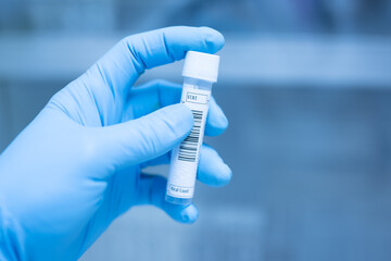 Close up scientist hand opening storage reagent container for laboratory analysis.Scientist hand...
