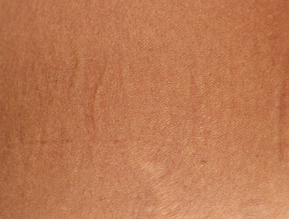 tan on the skin as a background