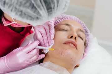 Cosmetic procedure for biorevitalization and removal of wrinkles for a young beautiful girl....