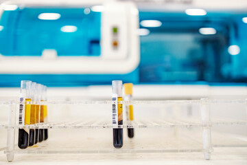 The test tubes with blood samples on a rack in a laboratory. Measuring d-dimer and antibodies during corona virus pandemic.