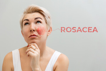 Portrait of an adult thoughtful beautiful woman with rosacea on her cheek. Concept of couperose