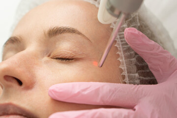 close-up Doctor cosmetologist makes the procedure of laser dermal rejuvenation of the eyelids of...
