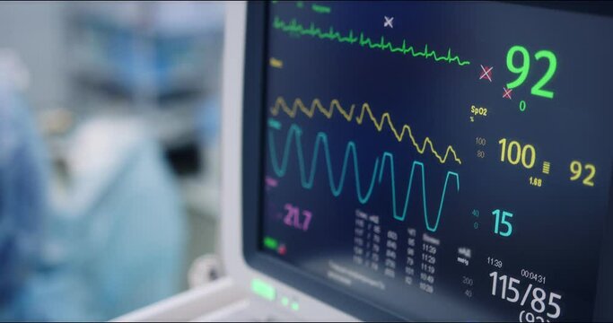 Artificial lung ventilation device. A heart monitor in the clinic. Heart rate monitor during surgery in the surgical department. Life support equipment. SARS-COV-2 COVID-19 Coronavirus