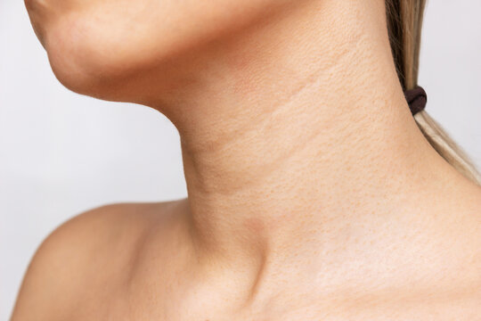 A close-up view of a young woman's neck isolated on a white background. Lines on the neck. Wrinkles, age-related changes, rings of Venus, goosebumps