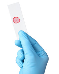 Scientist holding microscope slide with sample on white background, closeup
