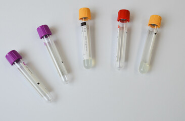 samples from test tubes, flat lay. Space for text, minimal gray background. Space for text