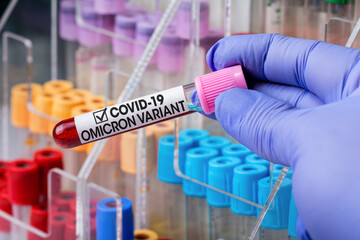 Technician lab with blood sample of New Variant of Covid-19 called Omicron. Doctor in analysis...